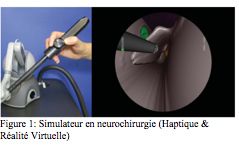 Zone de texte:  Figure 2: Simulateur en neurochirurgie (Haptique & Ralit Virtuelle)
